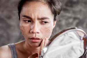 Sắc tố melanin có ở đâu trên cơ thể người?